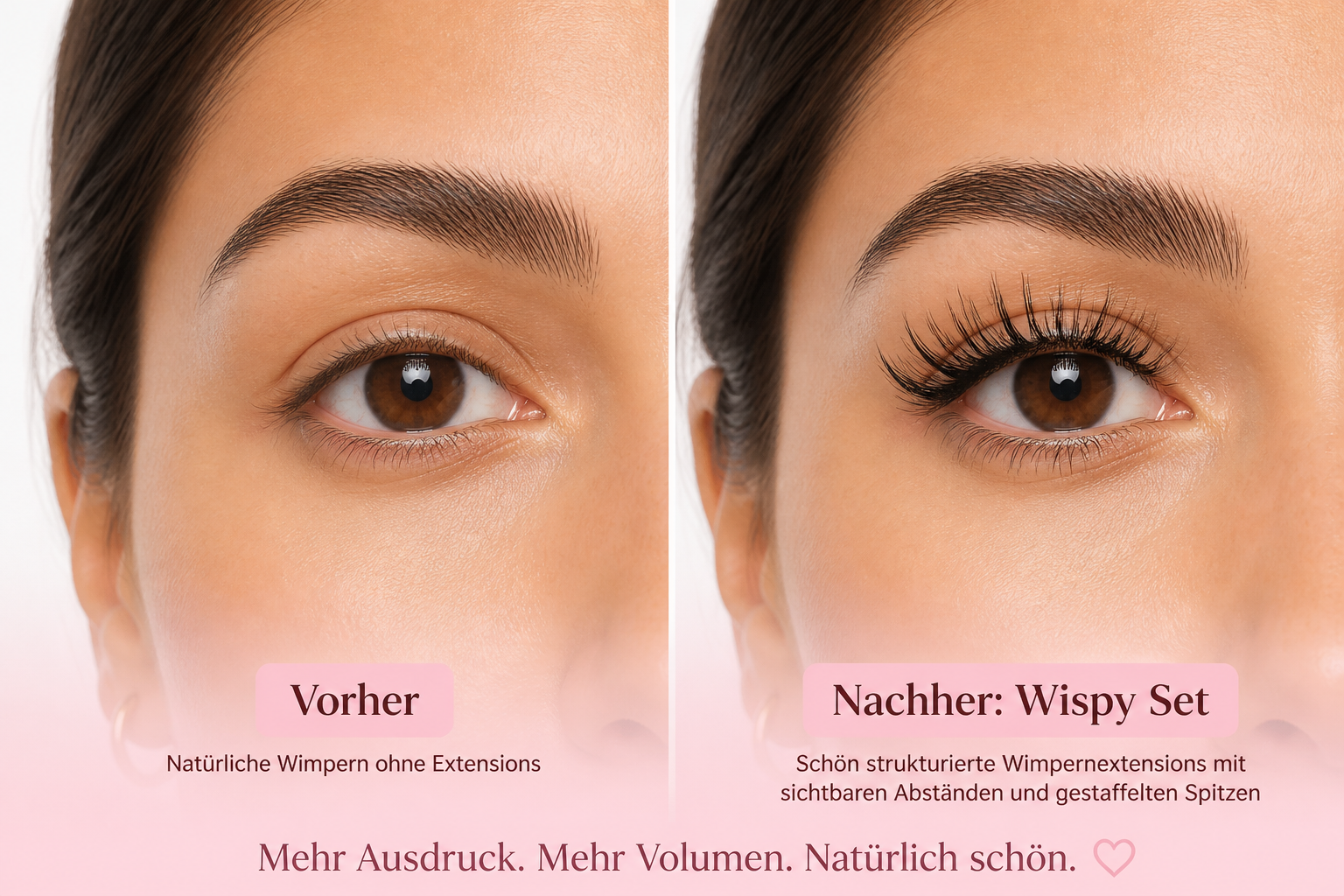 Detailed () showing a split-screen before-and-after comparison of a woman's eye area, left side labeled 'Vorher' showing